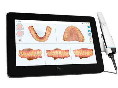 口腔内デジタルスキャナー（iTero）